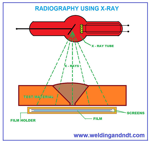 Radiography Radiography